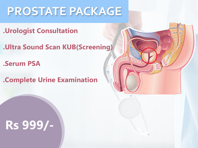 Prostate Package